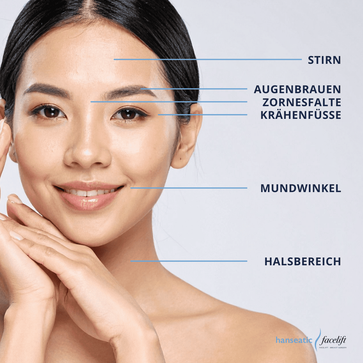 Bereiche der Faltenbehandlung mit Baby-Botox in Hamburg