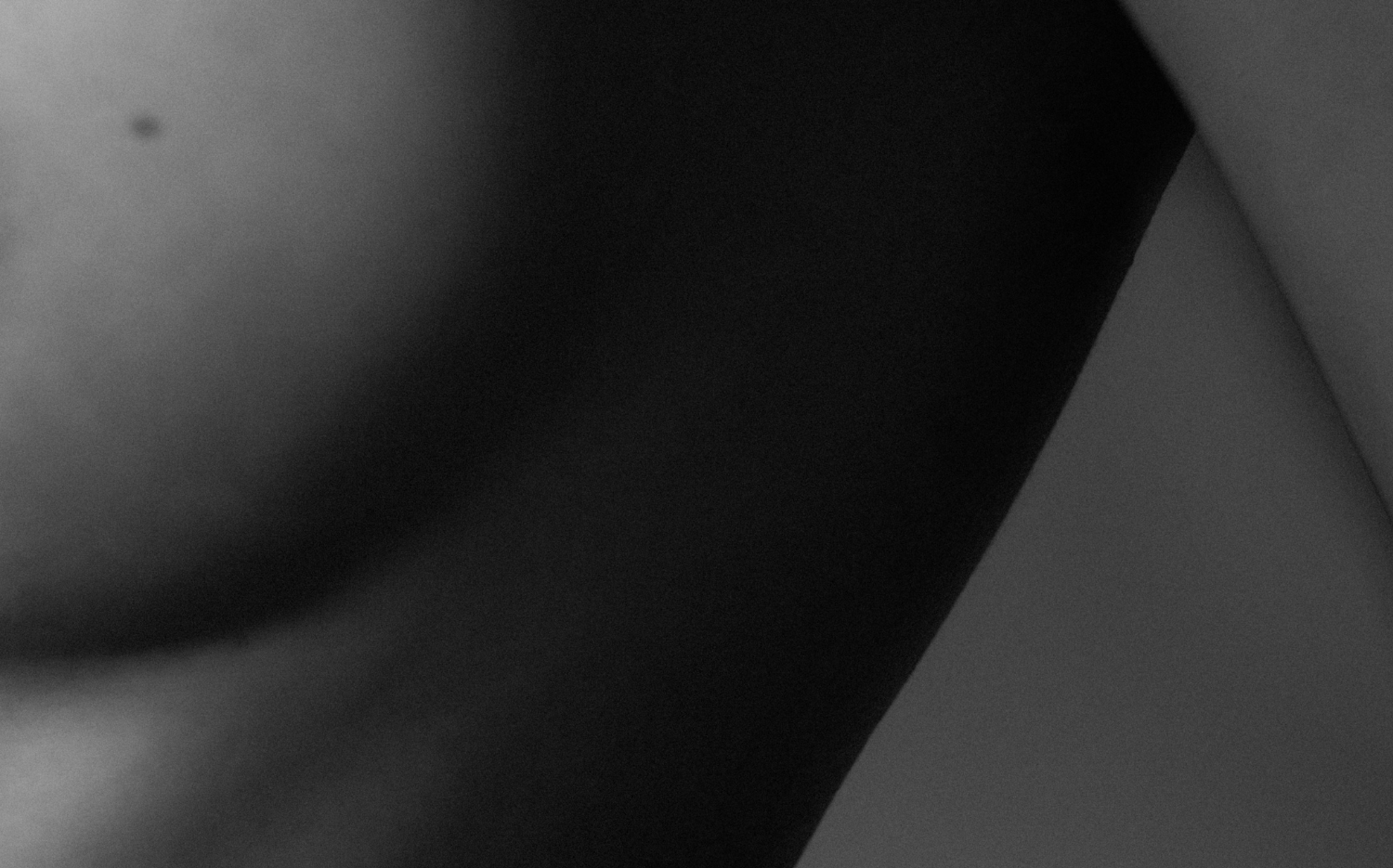 Gynäkomastie in Hamburg